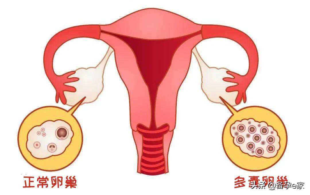 关于香港验血鉴别的合法性,备孕必知：排卵试纸的这些“秘密”，你读懂了吗