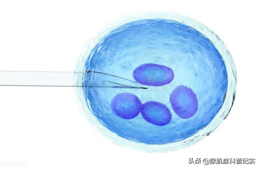 香港哪个机构可以验血测男女,腺肌症患者在什么情况下可以做试管婴儿？