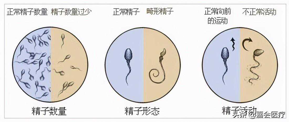 香港验血权威中心,迟迟不见好「孕」？医生提醒：不孕不育，先检查男性