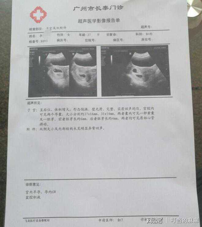香港验血查男女准确率-最简单的看胎儿的性别