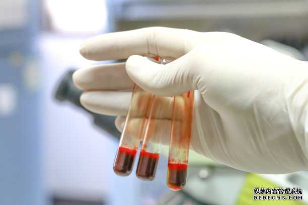 香港医院验血上班时间_有必要了解:香港抽血验性别牢靠吗?共享我在香港验血的