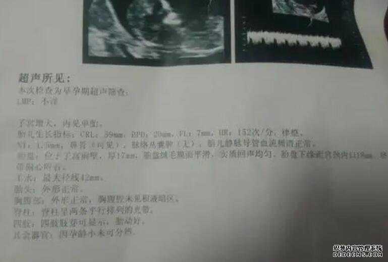 香港验血邮寄五天可以吗_怀孕几周可以去香港查男女_验血查男女多久能出结果