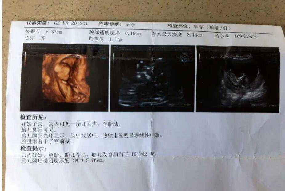 香港验血合法 打胎的多么_香港验血胎心比胎芽重要_验血攻略及流程说明!