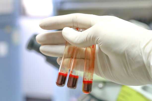 香港验血费用保香港卓信_高效的性别检测方法老品牌牢靠