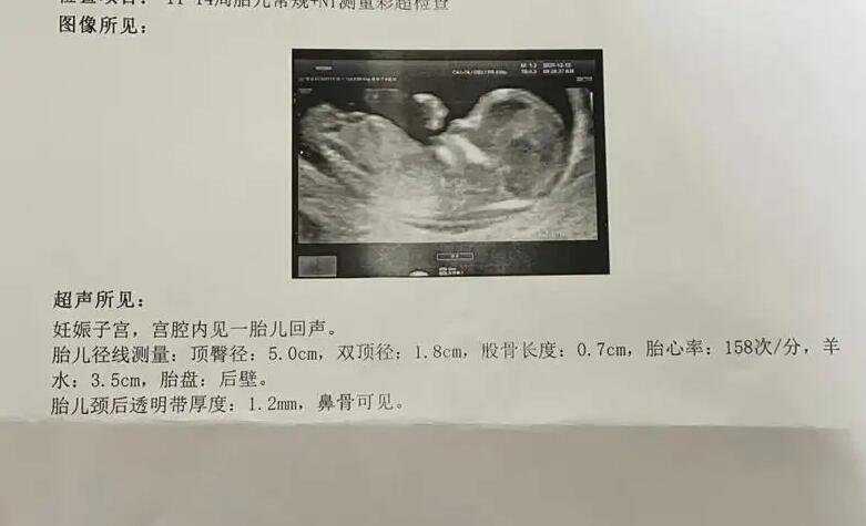 香港验血在香港法律允许吗_怀孕如何去香港验血,验血只要2600是真的吗？