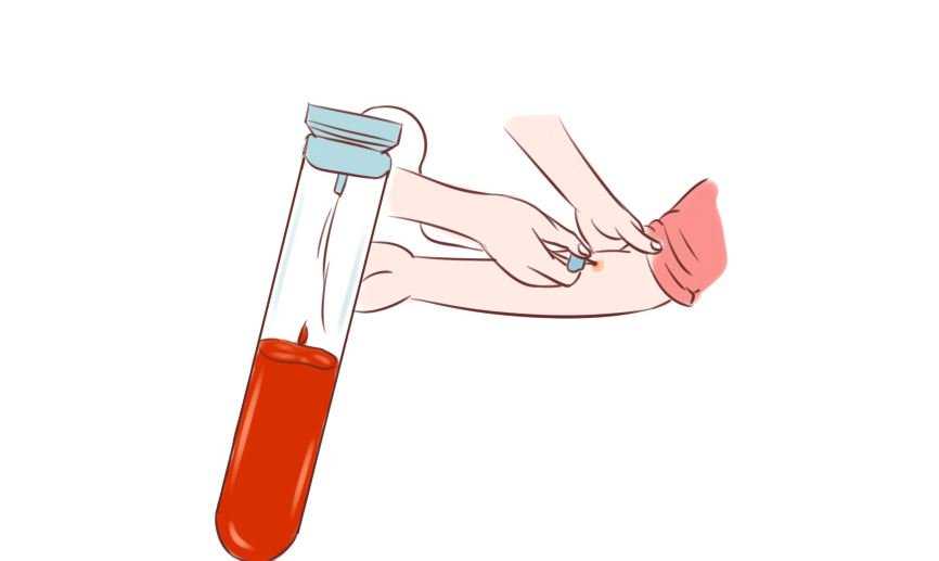 香港验血寄血抽血试管可以打开吗_专业的DNA检测部分查验保证