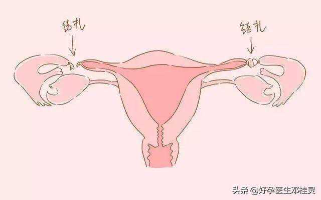 去香港验血是否怀孕要多少钱,备孕科普：输卵管结扎后又想要孩子，怎样做能